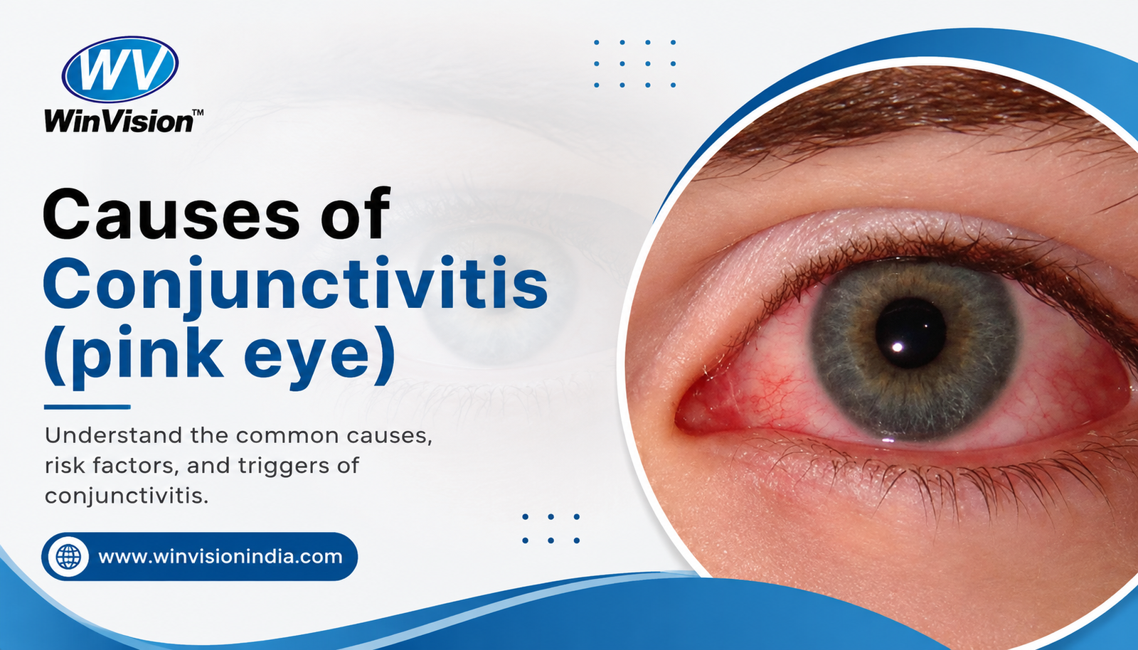 Causes Of Conjunctivitis