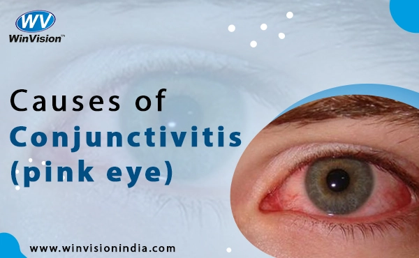 Causes of Conjunctivitis