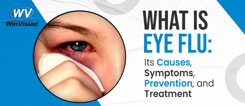 What is Eye Flu Its Causes, Symptoms, Prevention, and Treatment