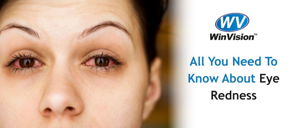 All You Need To Know About Eye Redness
