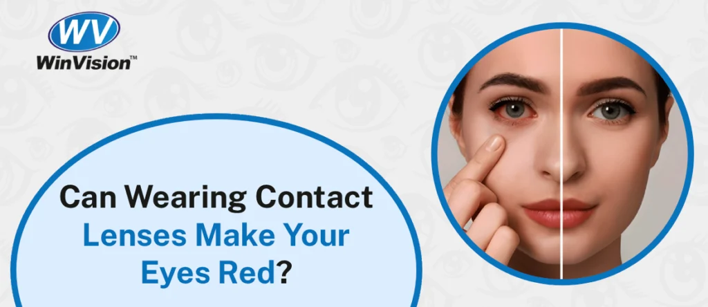 Can Wearing Contact Lenses Make Your Eyes Red