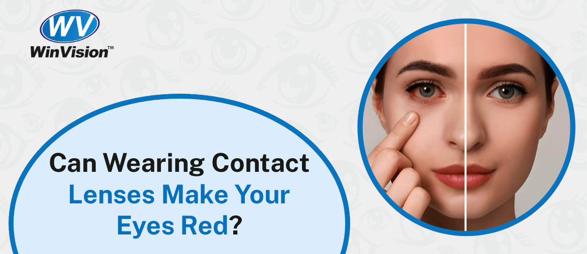 Can Wearing Contact Lenses Make Your Eyes Red