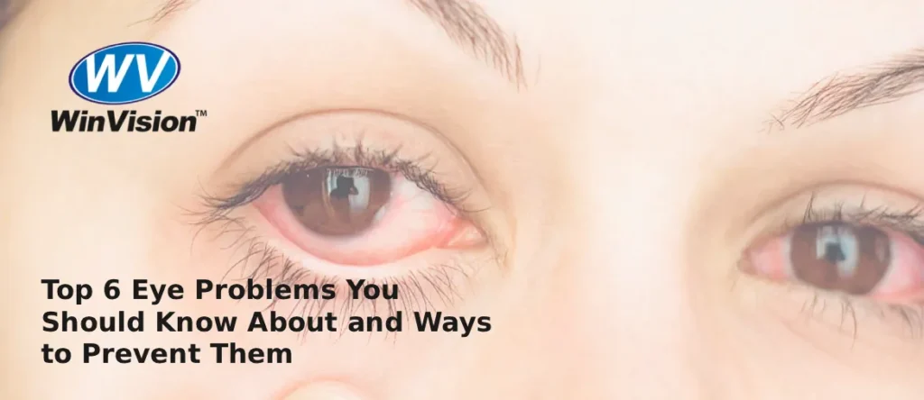 Top 6 Eye Problems You Should Know About and Ways to Prevent Them