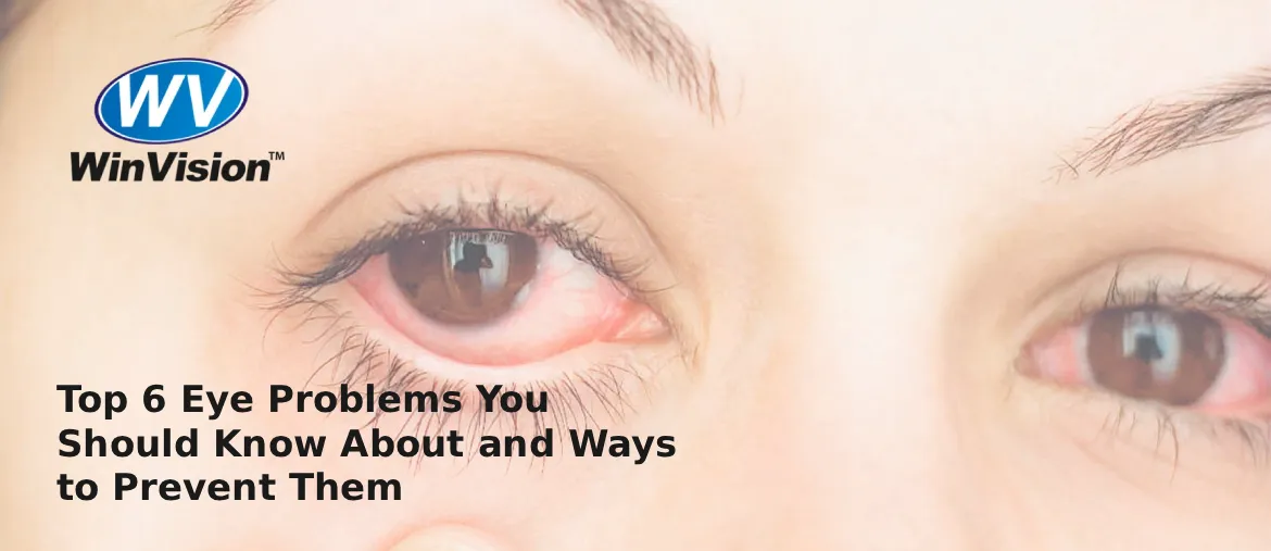 Top 6 Eye Problems You Should Know About and Ways to Prevent Them